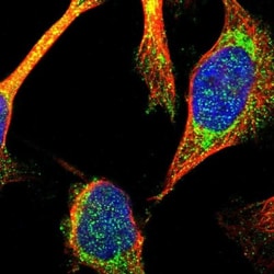 TTC19 Antibody, Novus Biologicals:Antibodies:Primary Antibodies